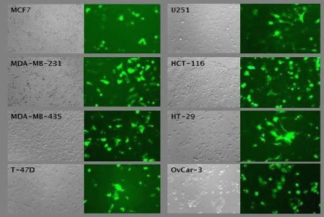 Lipofectamine® LTX in the presence of PLUS™ Reagent is an excellent choice for transfection of human cancer cell lines as well as primary and stem cells. The reagent enables the delivery of  high transfection performance without associated cytotoxicity